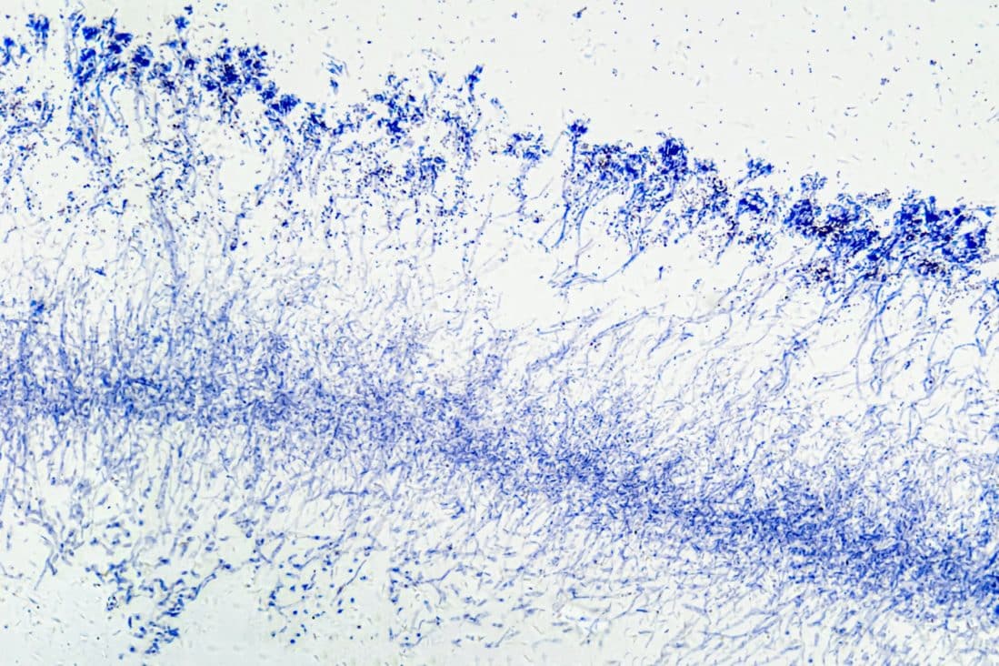 Penicillium, Hyphae And Mycelium Magnified Under A Microscope